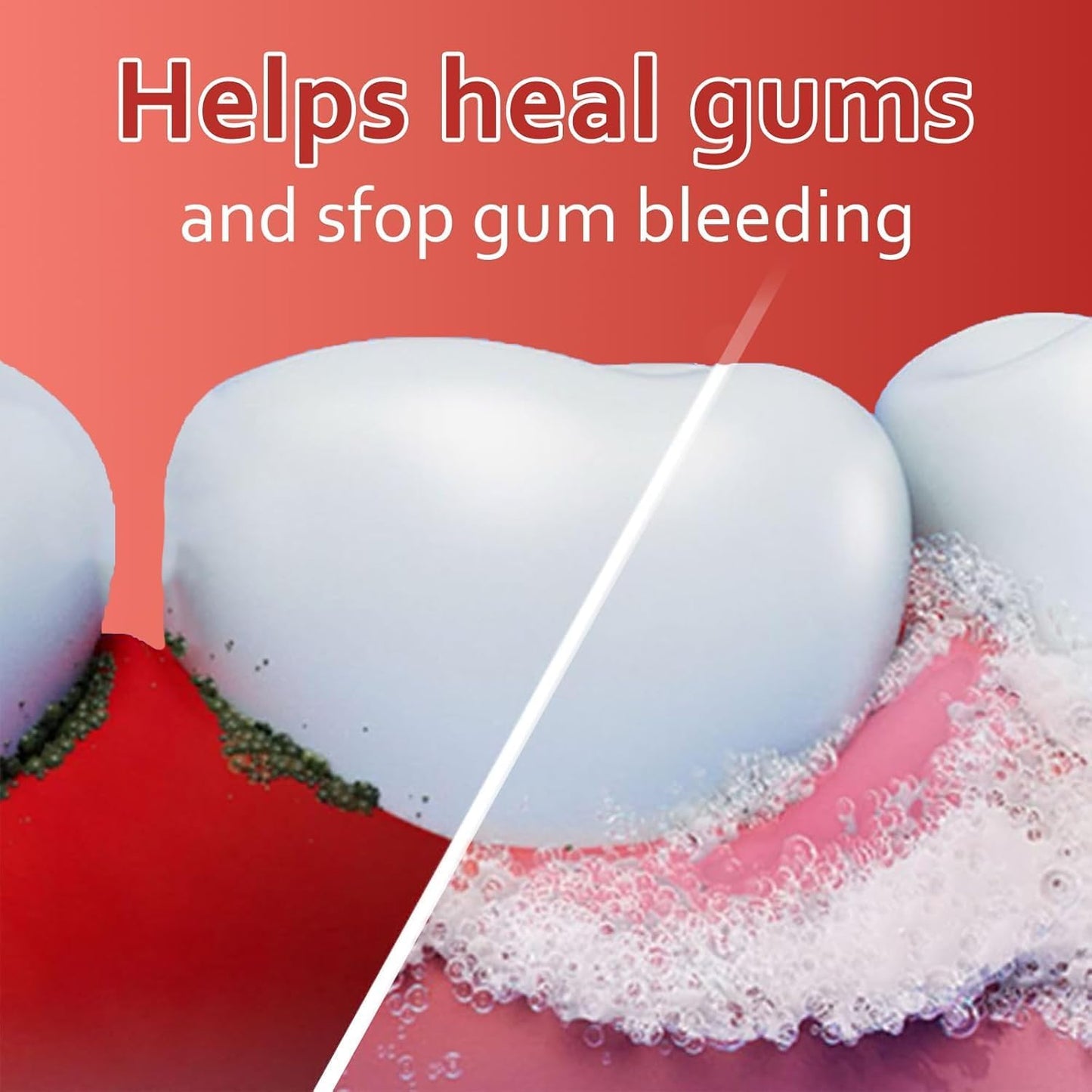 Super Probiotic-6 Toothpaste with 6 Probiotics oalance Oral microbiota strength