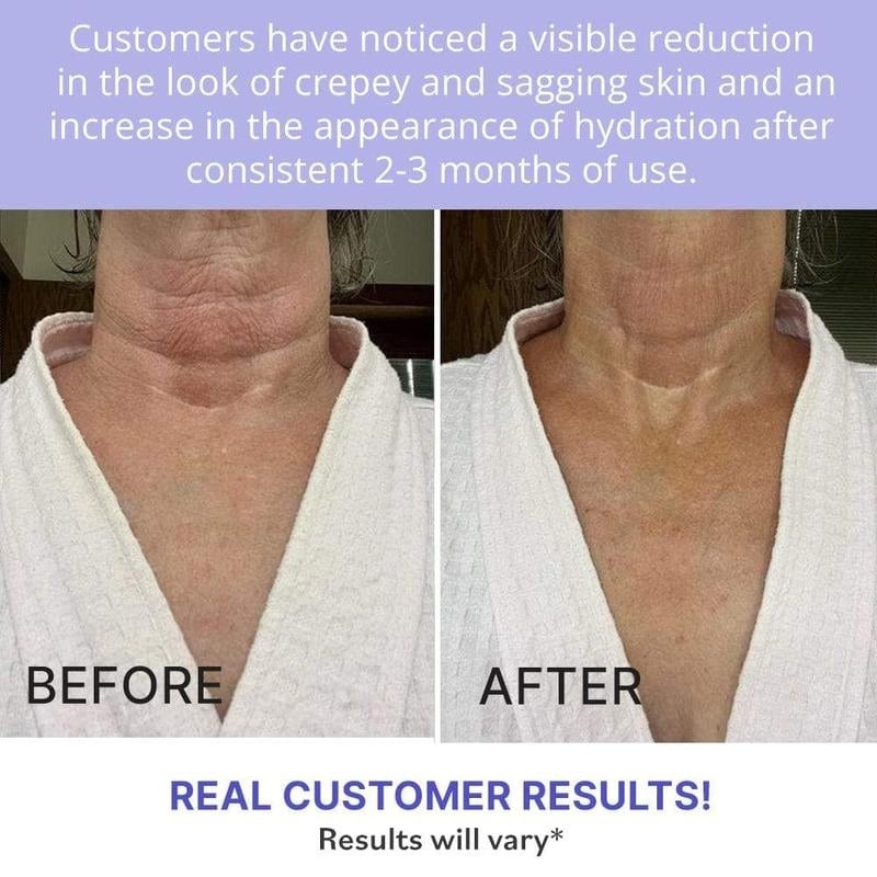 💕Hot sale 49% OFF💖Neck Cream, Anti-Aging Neck Firming Cream