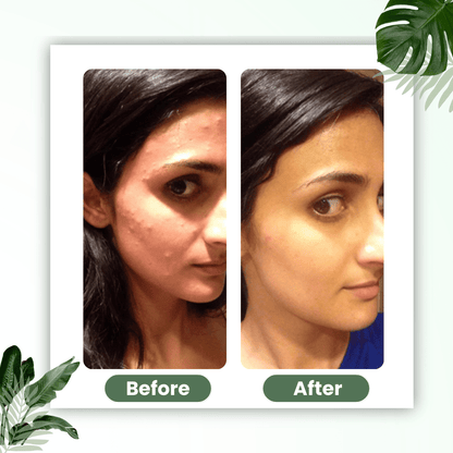 Natravor®  Green Tea Deep Cleanse Mask Stick ACE 1