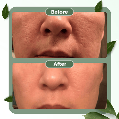 Natravor®  Green Tea Deep Cleanse Mask Stick ACE 1