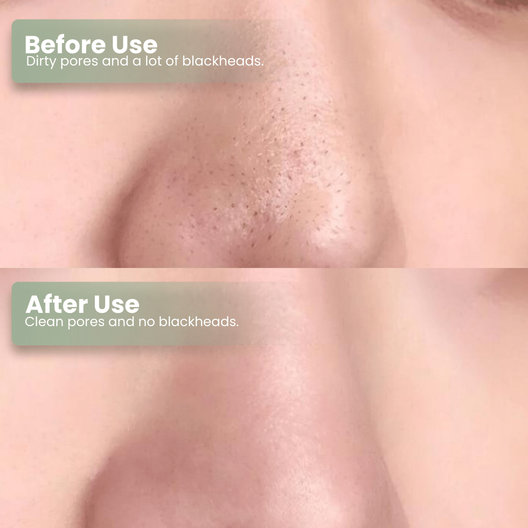 Natravor®  Green Tea Deep Cleanse Mask Stick ACE 1