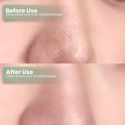 Natravor®  Green Tea Deep Cleanse Mask Stick ACE 1